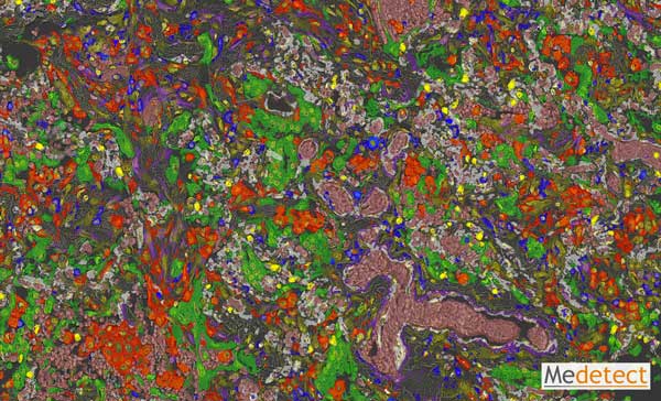 Multiplex immunohistochemistry