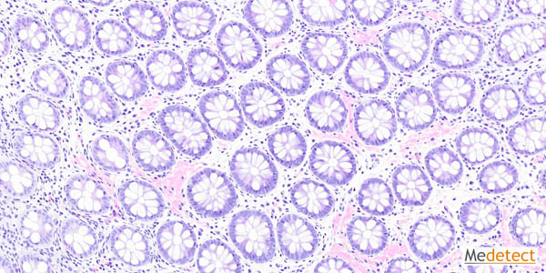 Hematoxylin and eosin (H&E) staining of human gastrointestinal tract