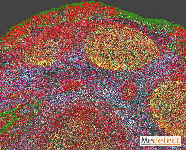 Human primary lymphoid tissue