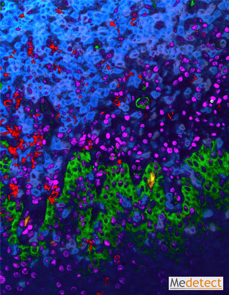 5-plex immunofluorescence histochemistry