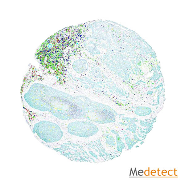 Multiplex immunohistochemistry