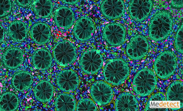 Mixed cell populations in human gastrointestinal tract