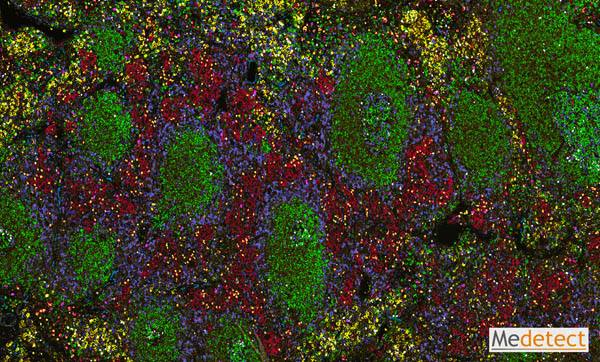 Immune cell patterns in lung-draining lymph node