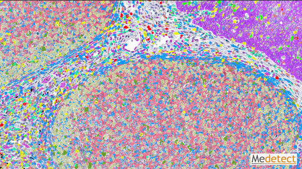 Human tonsil tissue