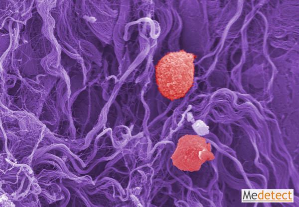 Extracellular matrix fibers