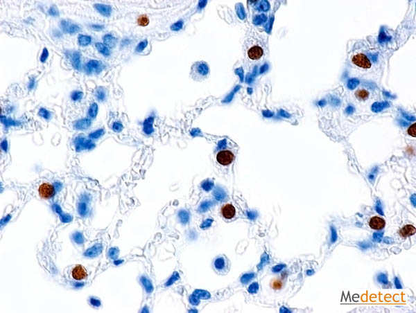 Alarmin interleukin 33 (IL-33) in the mouse lung