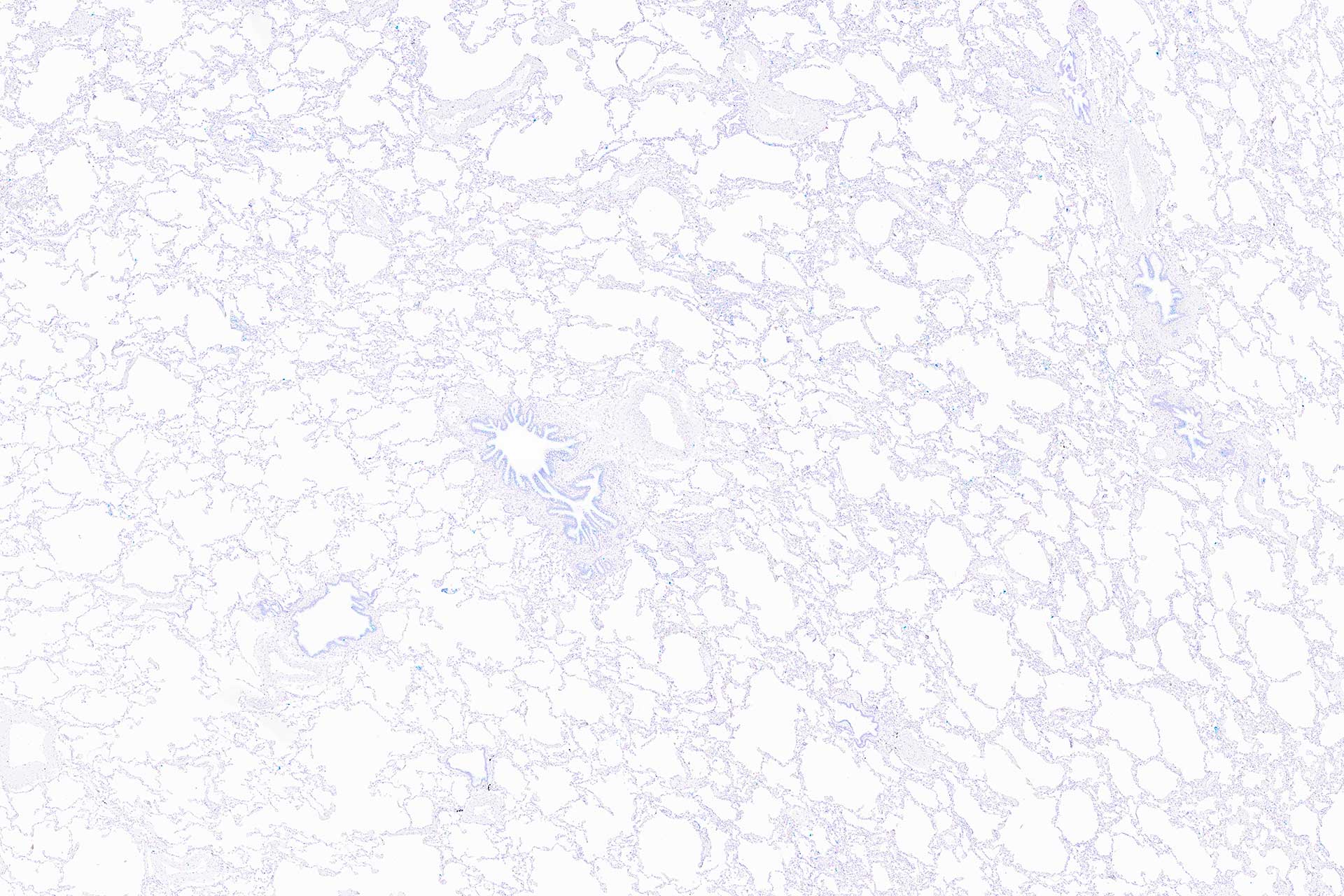 Tissue