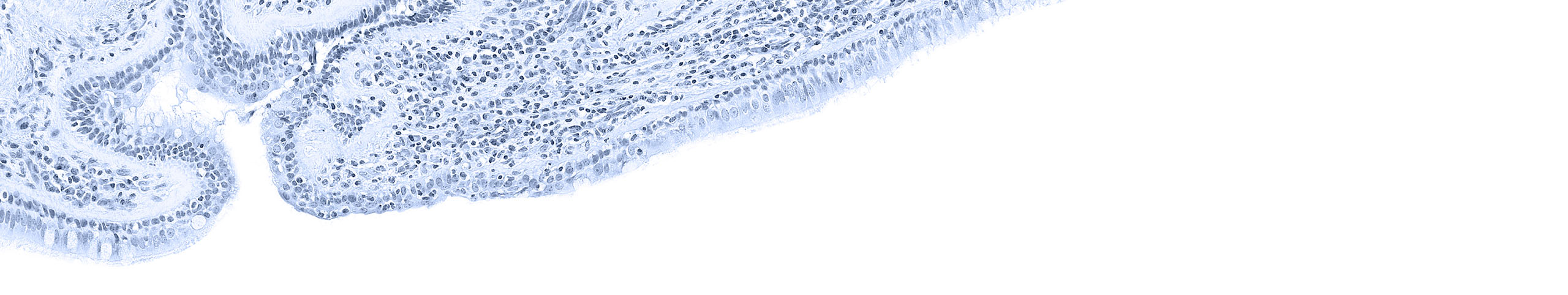 Airway Inflammation